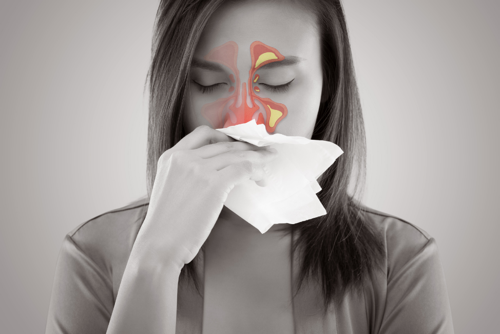 Sinusitis Got You Down?